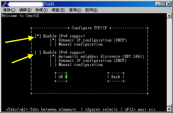 設定 IP 取得為 DHCP 或者是手動直接給予 (Manual)